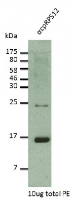 RPS12 | Ribosomal protein S12 (chloroplastic) in the group Antibodies for Plant/Algal / Membrane Transport System / Endomembrane system at Agrisera AB (Antibodies for research) (AS12 2114)